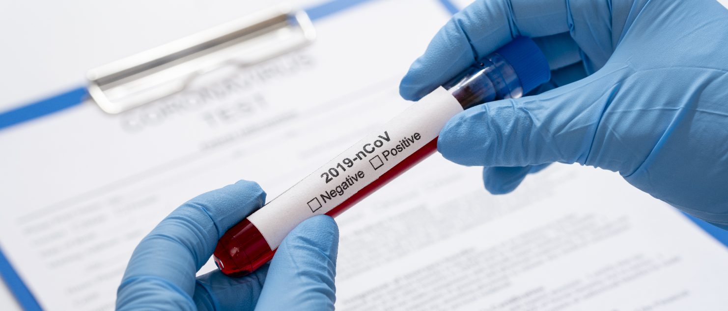 Regulation-for-employees-during-the-Covid-19-epidemic-in-Vietnam-15